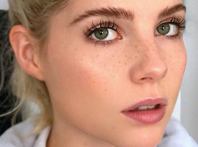 Khi những nốt tàn nhang trở thành điểm bắt mắt trên gương mặt